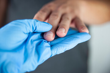 Hands with fungal skin lesions. Skin diseases caused by fungi