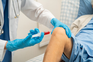 Asian doctor inject Hyaluronic acid platelet rich plasma into knee of senior woman.
