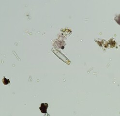 Brightfield micrograph of Cymbella sp. diatom at 200x magnification, NA 0.50