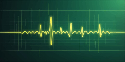 Green heart EKG line on a medical monitor