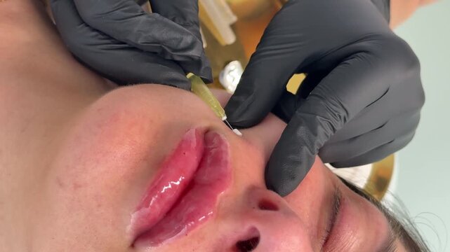Face lifting PDO Suture operation. innovative technique of New thread lift, cosmetologist preparing to do procedure to female client, select the appropriate thread option