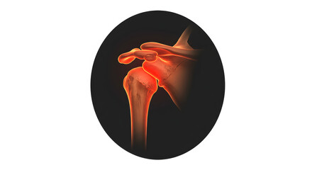 Shoulder Joint Pain Inflammation Medical Illustration Diagram