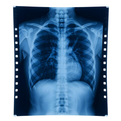 X-ray film with chest scan isolated on white background, PNG