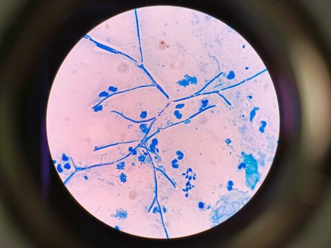 Microscopic view of fungi present in human sputum sample. 