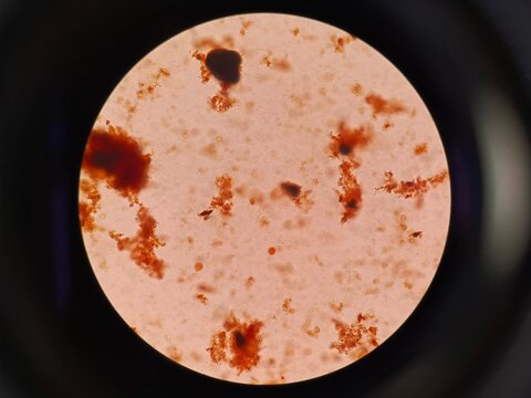 Microscopic view of blastocysts in a human fecal sample. 
