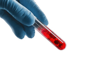 Obraz premium A gloved hand holds a test tube filled with a red liquid. The liquid appears viscous and contains small particles. Dark background