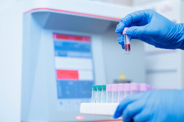 Gloved hands handling blood samples of dog in veterinary clinic laboratory setting