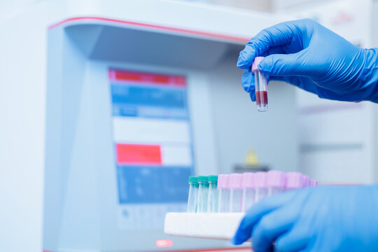 Gloved hands handling blood samples of dog in veterinary clinic laboratory setting