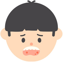 Mouth Ulcer and Canker Sore Medical Illustration