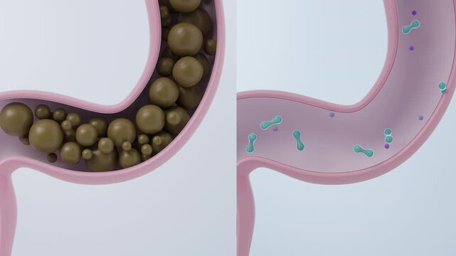 Gut health comparison animation of unhealthy constipation vs healthy digestion with probiotics