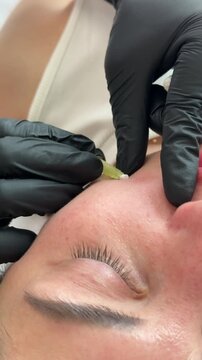 Face lifting PDO Suture operation. innovative technique of New thread lift, cosmetologist preparing to do procedure to female client, select the appropriate thread option