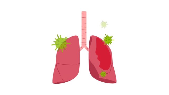 Lung disease illustration animation. Respiratory disease