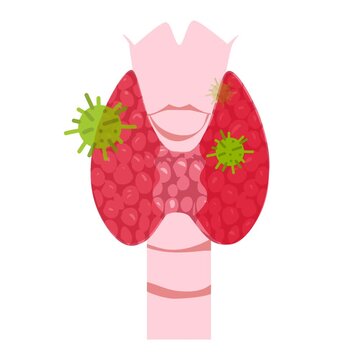 Thyroid disease illustration animation 