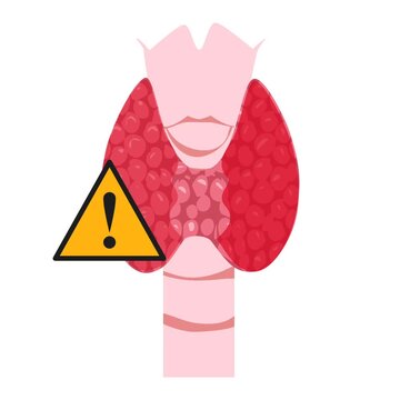 Thyroid disease illustration animation 