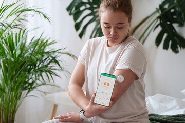 Young woman with diabetes synchronizing smart phone with sensor on arm at home