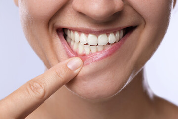 Woman showing her teeth and gums on light background, closeup