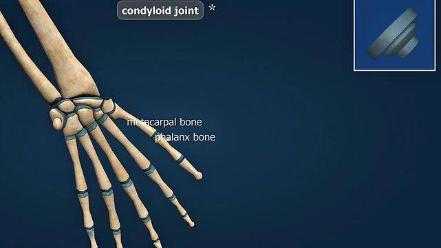 Condyloid joint