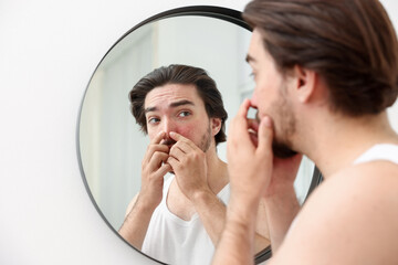 Young man with acne problem near mirror at home