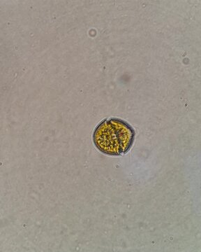 
Brightfield video of dinoflagellate protist at 1000x magnification