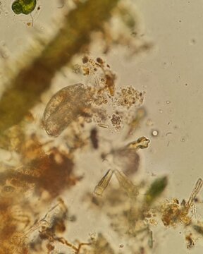 Brightfield micrograph video of Brachionus rotifer at 500x magnification

Tags:
