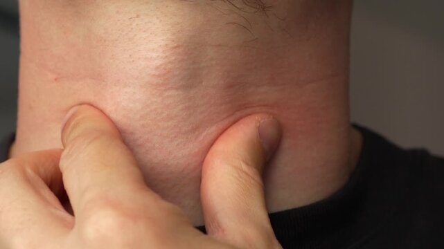 Sore throat.
Inflamed tonsils during tonsillitis.
Symptoms of flu and colds in men.
An adult man suffers from a sore throat.
Sore throat during a pandemic.
Medicine, treatment, cold