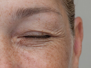 Close up cropped view of a middle aged laughing woman with wrinkles around her closed eye