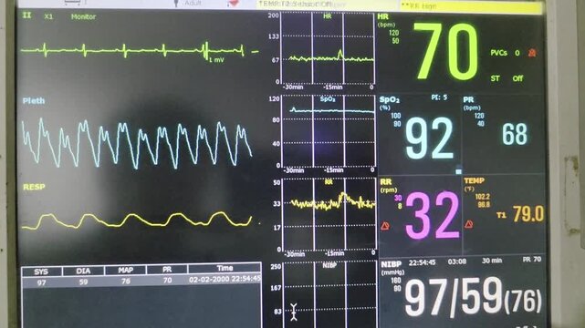 Advanced ICU Monitor Displaying Heart Rate and ECG Waveform