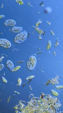 Microscopic View of Single-Celled Ciliates and Diatoms at 100x Magnification