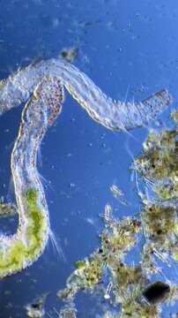 Microscopic View of Freshwater Annelid Aeolosoma at 100x Magnification