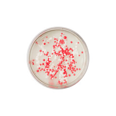 Petri Dish with Red and White Bacterial Colonies, Microbiology Lab Sample
