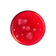 Petri Dish with Bacterial Colonies on Red Agar - Microbiology Science Image