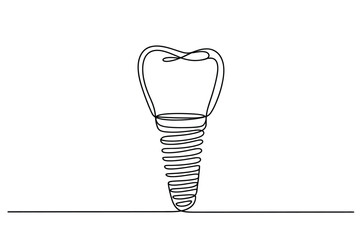 Single Line Drawing of a Tooth Implant – Minimalist Dentistry Icon