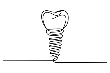 Minimal Line Drawing of a Dental Implant – Continuous Line Dental Illustration