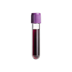 Blood Sample in Test Tube with Purple Cap - Medical Laboratory Science