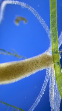 Hydra under the microscope at 40x Magnification