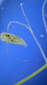 Hydra under the microscope at 40x Magnification