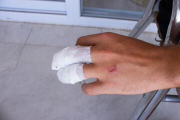 A person's open hand is shown with two fingers wrapped in white bandages, indicating an injury or medical treatment