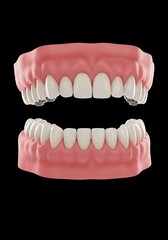Obraz premium A dental model showing the upper and lower sets of teeth with pink gums on a black background