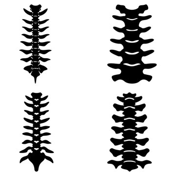 Four anatomical spine illustrations showing the vertebral column in black silhouette on a white background