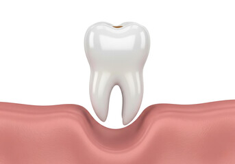 Fototapeta premium Dental Anatomy: 3D Render of a Molar Tooth and Gum Socket, Illustrating Oral Health & Extraction Concepts