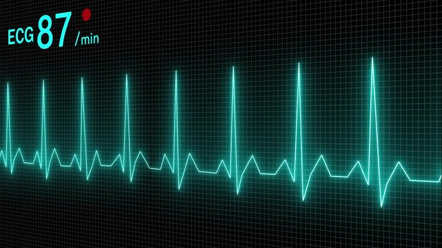 Heartbeat monitor EKG line monitor showing heart pulse .Neon sign heartbeat signal animation , Glowing white color neon heartbeat icon. Heart bit signal animated - Powered by Adobe