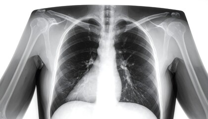 X-ray of the chest and upper body