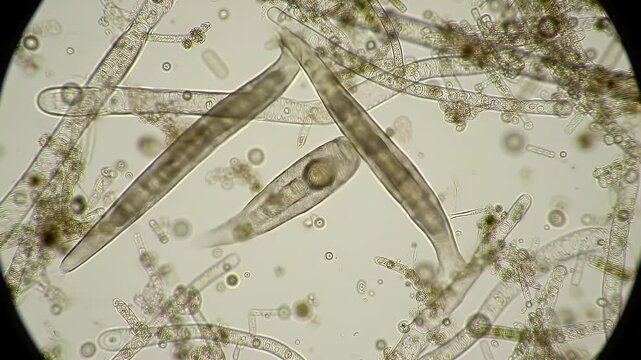 Detailed Microscopic View of Nematodes and Fungal Hyphae in Clear Fluid under High Powered Microscope Showing Transparent Worms and Filamentous Structures for Scientific Exploration