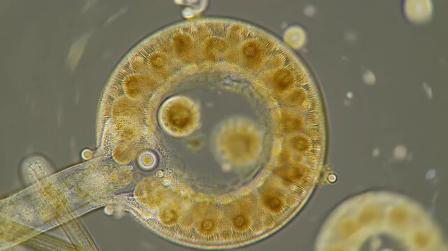 Detailed Microscopic View of Tintinnid Protozoa with Internal Structures and Translucent Shell in Brightfield Illumination for Scientific Research and Education Use Full Frame Close Up Shot
