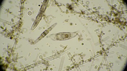 Dynamic Microscopic View of Protozoa Amidst Plant Debris in Bright Field Illumination Studying Diverse Microorganisms and Biological Structures within Aquatic Ecosystem Under High Magnification - Powered by Adobe