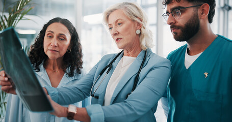 Doctors, x ray and people in clinic, teamwork or diagnosis with help, feedback or healthcare. Professional, medical group and employees in hospital, assessment of scan or cooperation with radiology