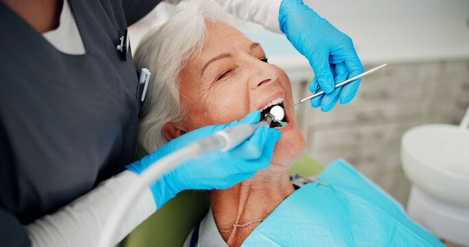Cleaning, tools and senior woman at dentist for teeth whitening treatment, dentures or oral hygiene. Healthcare, mouth and elderly patient in clinic for polish, dental care or plaque with brush