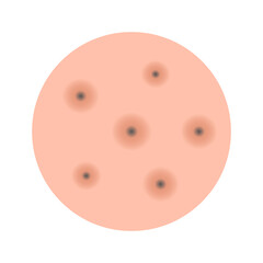 Acne facial type concept. vector illustration