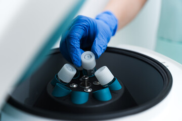 Laboratory technician wearing blue gloves carefully places test tubes into a centrifuge, preparing samples for analysis in a medical or scientific research setting