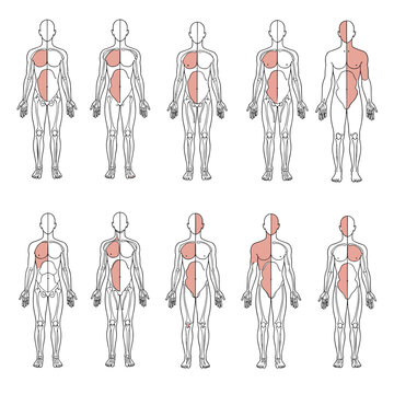 Understanding referred pain patterns in the human body illustrating various somatic zones